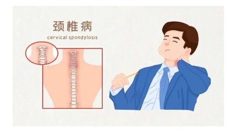 Mengenai insomnia? Pernahkah anda mempertimbangkan penyebab tulang belakang s...